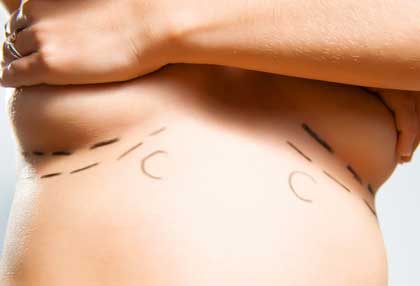 Brustchirurgie Bingen