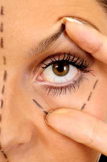 Augenbrauenstraffung Bingen